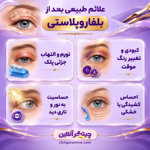 بررسی علائم طبیعی بعد از بلفاروپلاستی