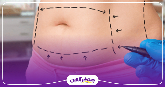 پیکرتراشی شامل چه روش‌هایی می‌شود؟